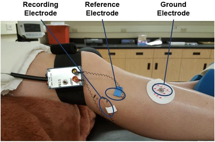 A supported lower leg with recording and reference microelectrodes connected to a head-stage amplifier and a surface ground electrode.